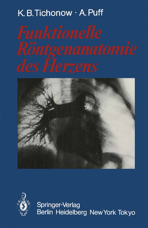 Funktionelle Röntgenanatomie des Herzens von Puff,  Alexander, Tichonow,  Konstantin B.