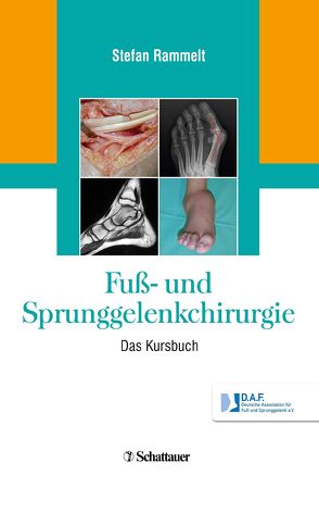 Fuß- und Sprunggelenkchirurgie von Rammelt,  Stefan