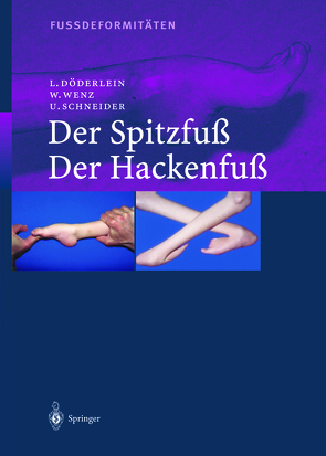 Fussdeformitäten von Döderlein,  Leonhard, Häfner,  R., Schneider,  Urs, Wenz,  Wolfram