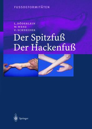 Fussdeformitäten von Döderlein,  Leonhard, Häfner,  R., Schneider,  Urs, Wenz,  Wolfram