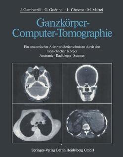 Ganzkörper-Computer-Tomographie von Amy,  D., Chevrot,  L., Galliano,  R., Gambarelli,  J., Guerinel,  G., Jacomy,  J.P., Mattei,  M., Nazarian,  S., Soler,  M.