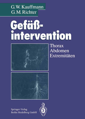 Gefäßintervention von Allenberg,  J.-R., Antonucci,  F., Düx,  M., Görich,  J., Herfarth,  C., Hoffmann,  V., Hohenberger,  P., Kauffmann,  G. W., Lammer,  J., Müller,  S.C., Richter,  G.M., Roeren,  T., Schild,  H., Sigmund,  G., Stuckmann,  G., Wenz,  W., Winkelbauer,  F., Zollikofer,  C.L.