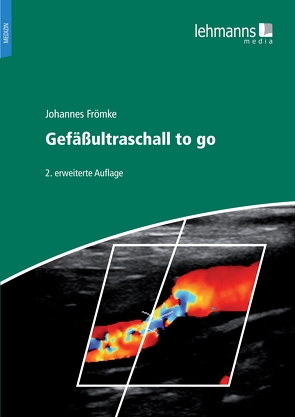 Gefäßultraschall to go von Frömke,  Johnnes