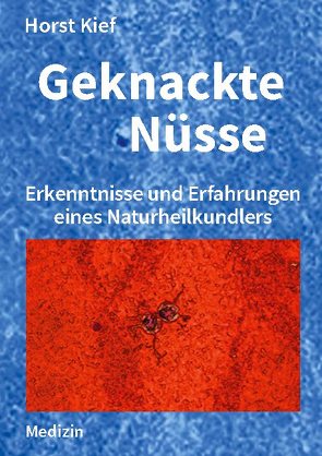 Geknackte Nüsse von Kief,  Horst