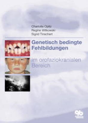 Genetisch bedingte Fehlbildungen im orofaziokranialen Bereich von Opitz,  Charlotte, Tinschert,  Sabine, Witkowski,  Regine