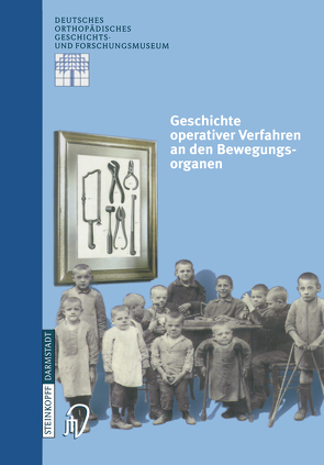 Geschichte operativer Verfahren an den Bewegungsorganen von Rauschmann,  M.A., Thomann,  K.-D., Zichner,  L.