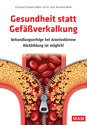 Gesundheit statt Gefäßverkalkung von Weber,  Christiane Elisabeth, Weber,  Dr. med. Bernhard