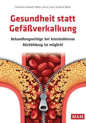 Gesundheit statt Gefäßverkalkung von Weber,  Christiane E., Weber,  Dr. med. Bernhard