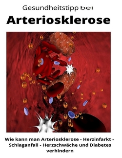 Gesundheitstipp bei Arteriosklerose von Loidl,  Maximilian