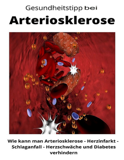 Gesundheitstipp bei Arteriosklerose von Loidl,  Maximilian