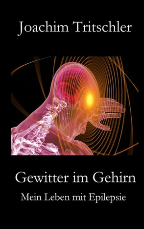 Gewitter im Gehirn von Tritschler,  Joachim