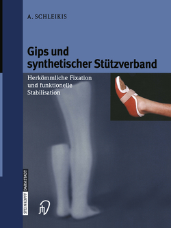 Gips und synthetischer Stützverband von Schleikis,  A., Stürmer,  K.-M.