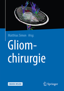 Gliomchirurgie von Simon,  Matthias