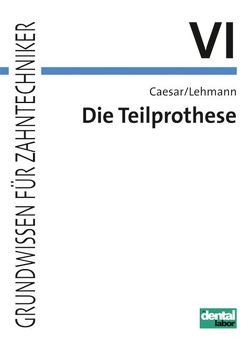 Grundwissen für Zahntechniker / Die Teilprothese von Caesar,  H Hans, Lehmann,  Klaus M.