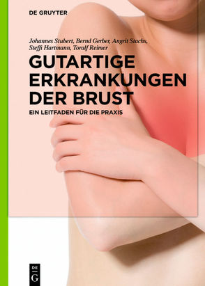 Gutartige Erkrankungen der Brust von Gerber,  Bernd, Hartmann,  Steffi, Reimer,  Toralf, Stachs,  Angrit, Stubert,  Johannes