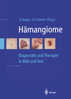 Hämangiome von Cremer,  H., Kautz,  G.