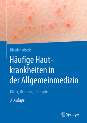 Häufige Hautkrankheiten in der Allgemeinmedizin von Abeck,  Dietrich