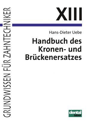 Handbuch des Kronen- und Brückenersatzes von Uebe,  Hans D