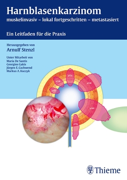 Harnblasenkarzinom von Stenzl,  Arnulf