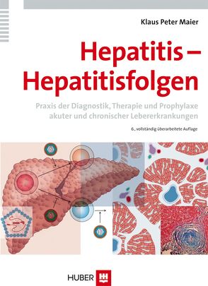 Hepatitis – Hepatitisfolgen von Maier,  Klaus-Peter