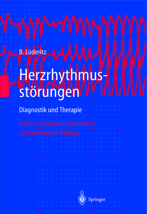 Herzrhythmusstörungen von Luederitz,  Berndt