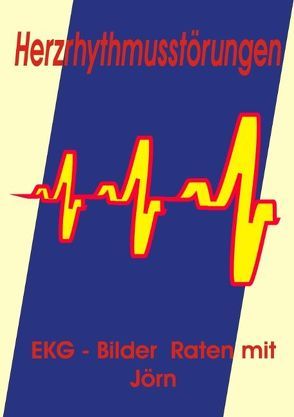 Herzrhythmusstörungen von Nickoleit,  Jörn