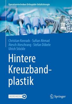 Hintere Kreuzbandplastik von Ahmad,  Sufian, Ateschrang,  Atesch, Döbele,  Stefan, Konrads,  Christian, Stöckle,  Ulrich