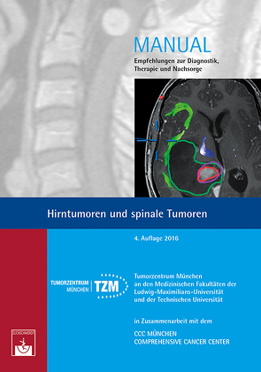 Hirntumoren und spinale Tumoren von Tumorzentrum München