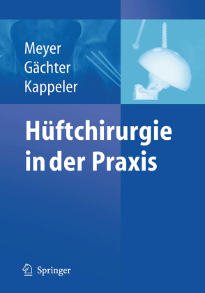 Hüftchirurgie in der Praxis von Gächter,  Andre, Kappeler,  Urs, Meyer,  Rainer-Peter