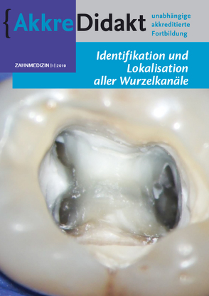 Identifikation und Lokalisation aller Wurzelkanäle von Drefs,  Michael