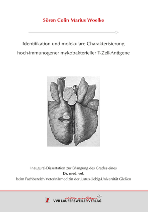 Identifikation und molekulare Charakterisierung hoch-immunogener mykobakterieller T-Zell-Antigene von Woelke,  Sören