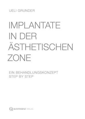 Implantate in der ästhetischen Zone von Grunder,  Ueli