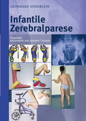 Infantile Zerebralparese von Döderlein,  L.