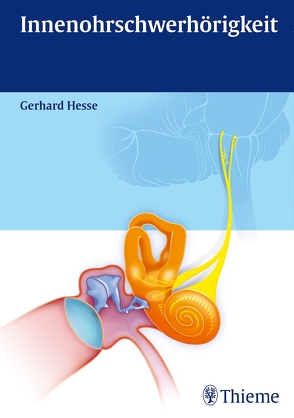 Innenohrschwerhörigkeit von Hesse,  Gerhard