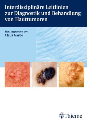 Interdisziplinäre Leitlinien zur Diagnostik und Behandlung von Hauttumoren von Bootz,  Friedrich, Breuninger,  Helmut, Brockmeyer,  Norbert H., Dummer,  Reinhard, Garbe,  Claus