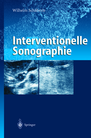 Interventionelle Sonographie von Schäberle,  Wilhelm