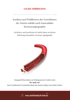 Inzidenz und Prädiktoren des Verschlusses der Arteria radialis nach transradialer Koronarangiographie von Herrmann,  Laura