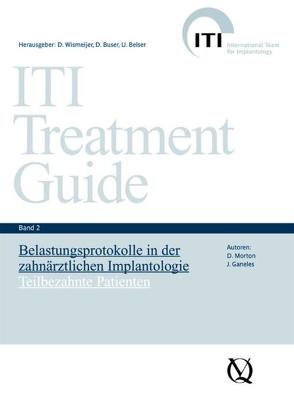 Belastungsprotokolle in der zahnärztlichen Implantologie von Belser,  Urs, Buser,  Daniel, Ganeles,  J, Morton,  D, Wismeijer,  Daniel