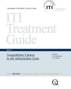 Ausgedehnte Lücken in der ästhetischen Zone von Buser,  Daniel, Chen,  Stephen, Weber,  Hans Peter, Wismeijer,  Daniel, Wittneben Matter,  Julia-Gabriela