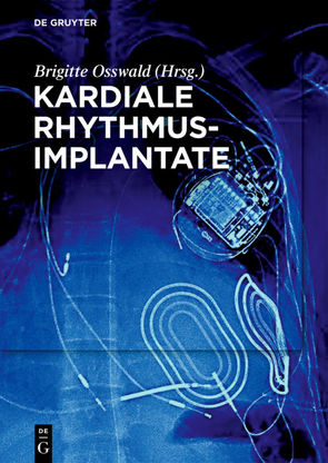 Kardiale Rhythmusimplantate von Osswald,  Brigitte