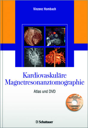 Kardiovaskuläre Magnetresonanztomographie von Hombach,  Vinzenz