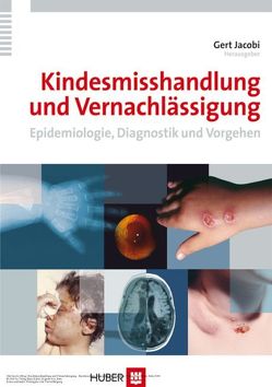 Kindesmisshandlung und Vernachlässigung von Jacobi,  Gert