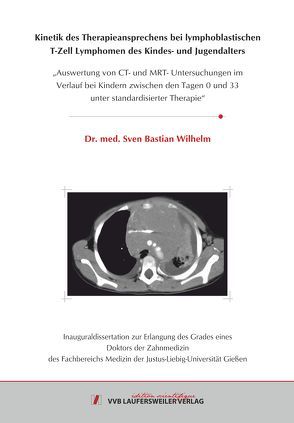 Kinetik des Therapieansprechens bei lymphoblastischen T-Zell Lymphomen des Kindes- und Jugendalters von Wilhelm,  Sven Bastian