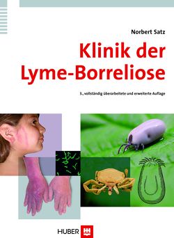 Klinik der Lyme-Borreliose von Satz,  Norbert