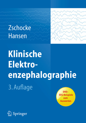 Klinische Elektroenzephalographie von Hansen,  Hans-Christian, Zschocke,  Stephan