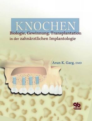 Knochen von Garg,  Arun K