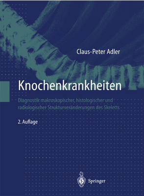 Knochenkrankheiten von Adler,  Claus-Peter