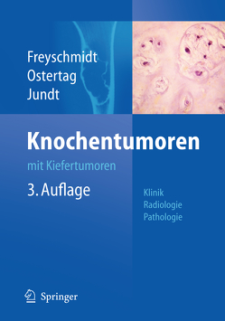 Knochentumoren mit Kiefertumoren von Freyschmidt,  Jürgen, Jundt,  Gernot, Ostertag,  Helmut