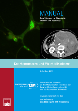 Knochentumoren und Weichteilsarkome von Lindner,  L.