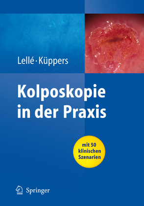 Kolposkopie in der Praxis von Küppers,  Volkmar, Lellé,  Ralph J.